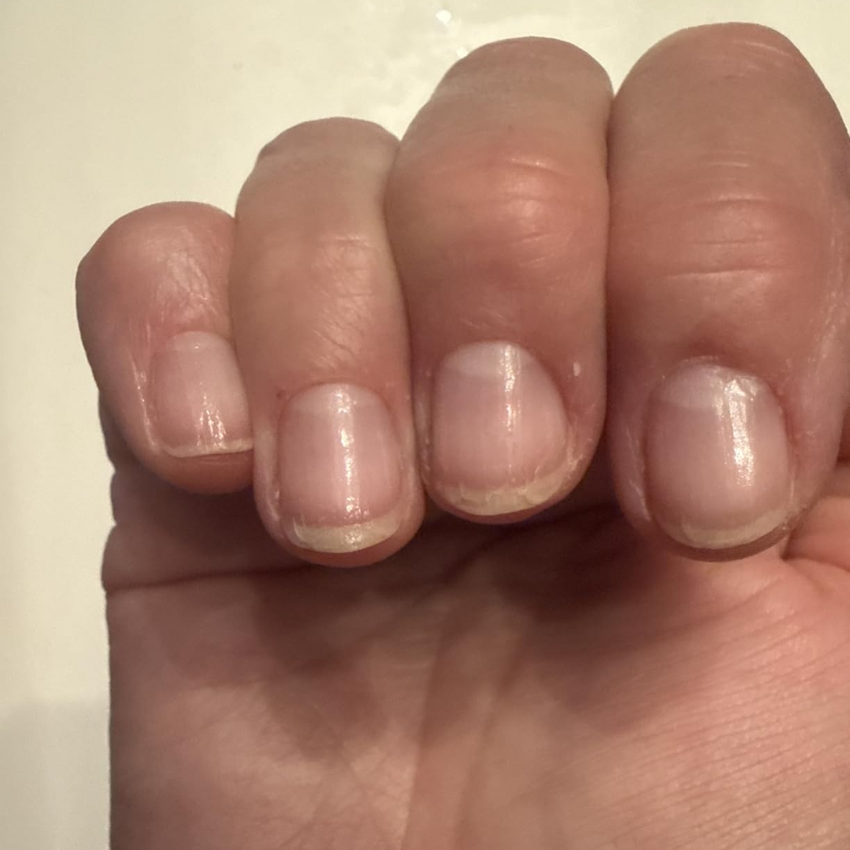 Before Duo Day & Night Nails Repair Treatment