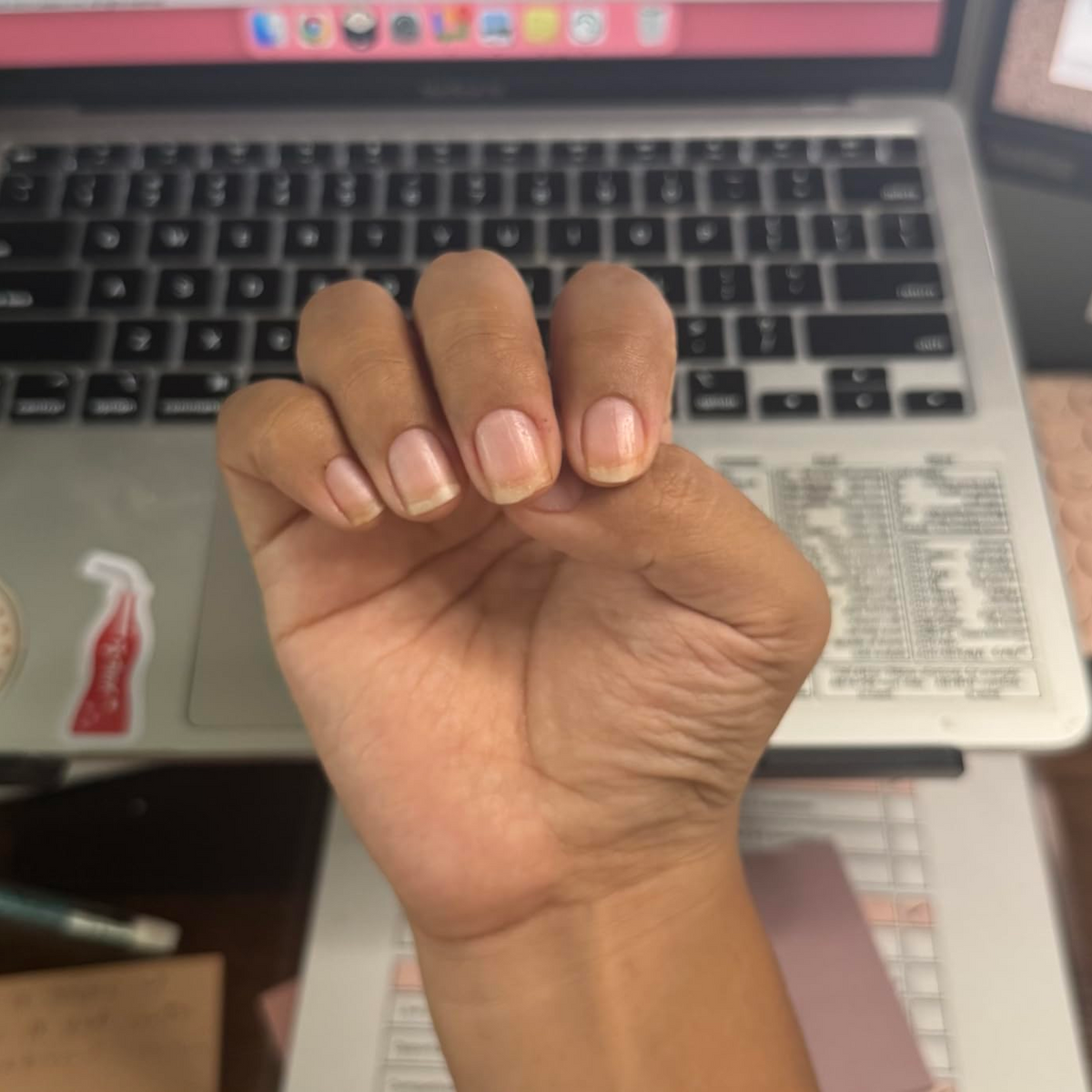 After Duo Day & Night Nails Repair Treatment
