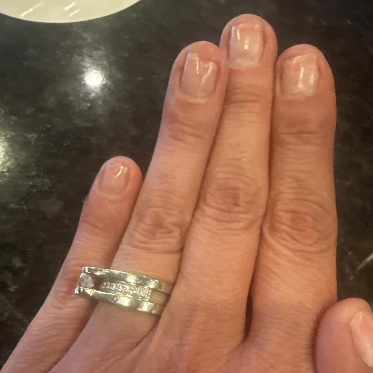 After Duo Day & Night Nails Repair Treatment