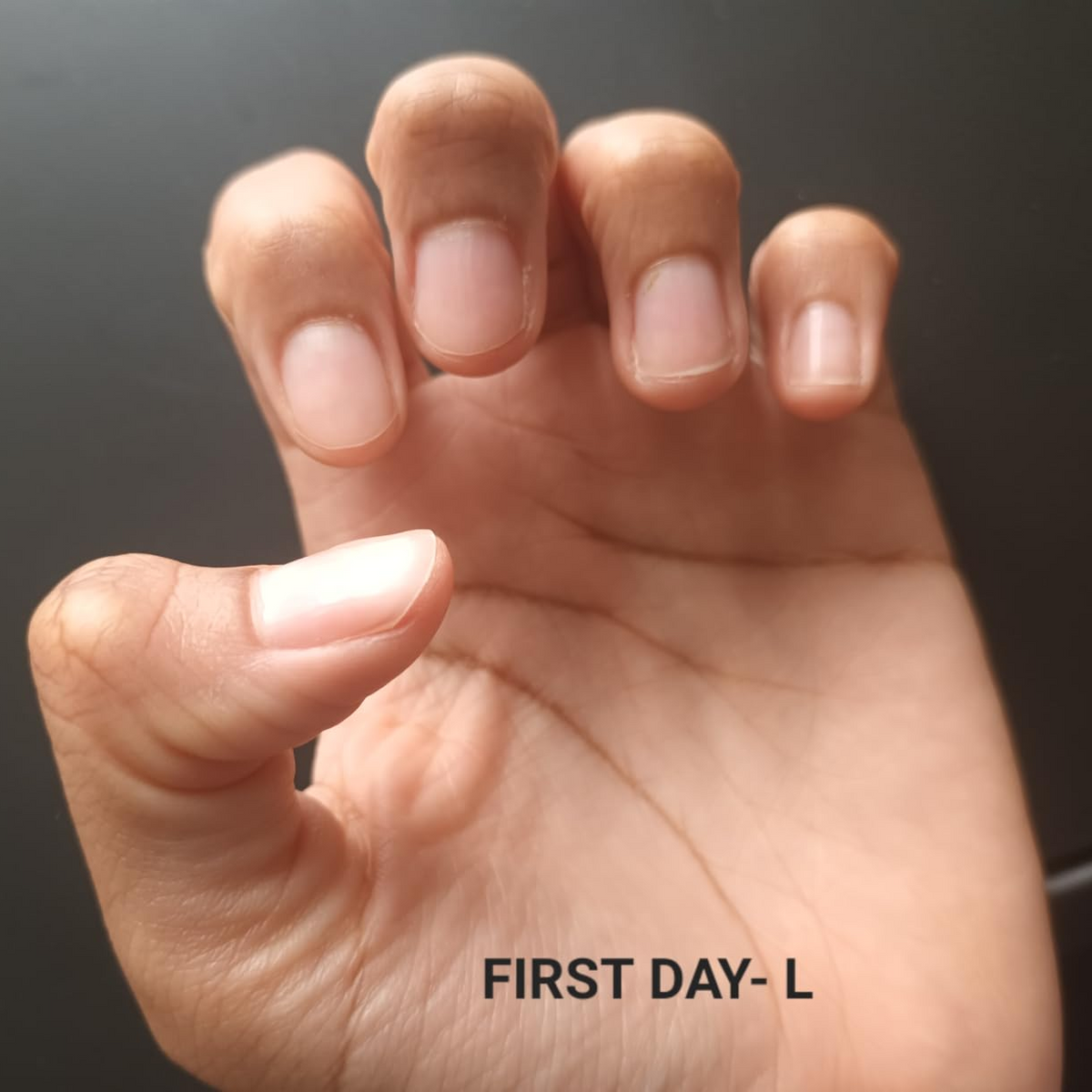 Before Nail Growth Serum