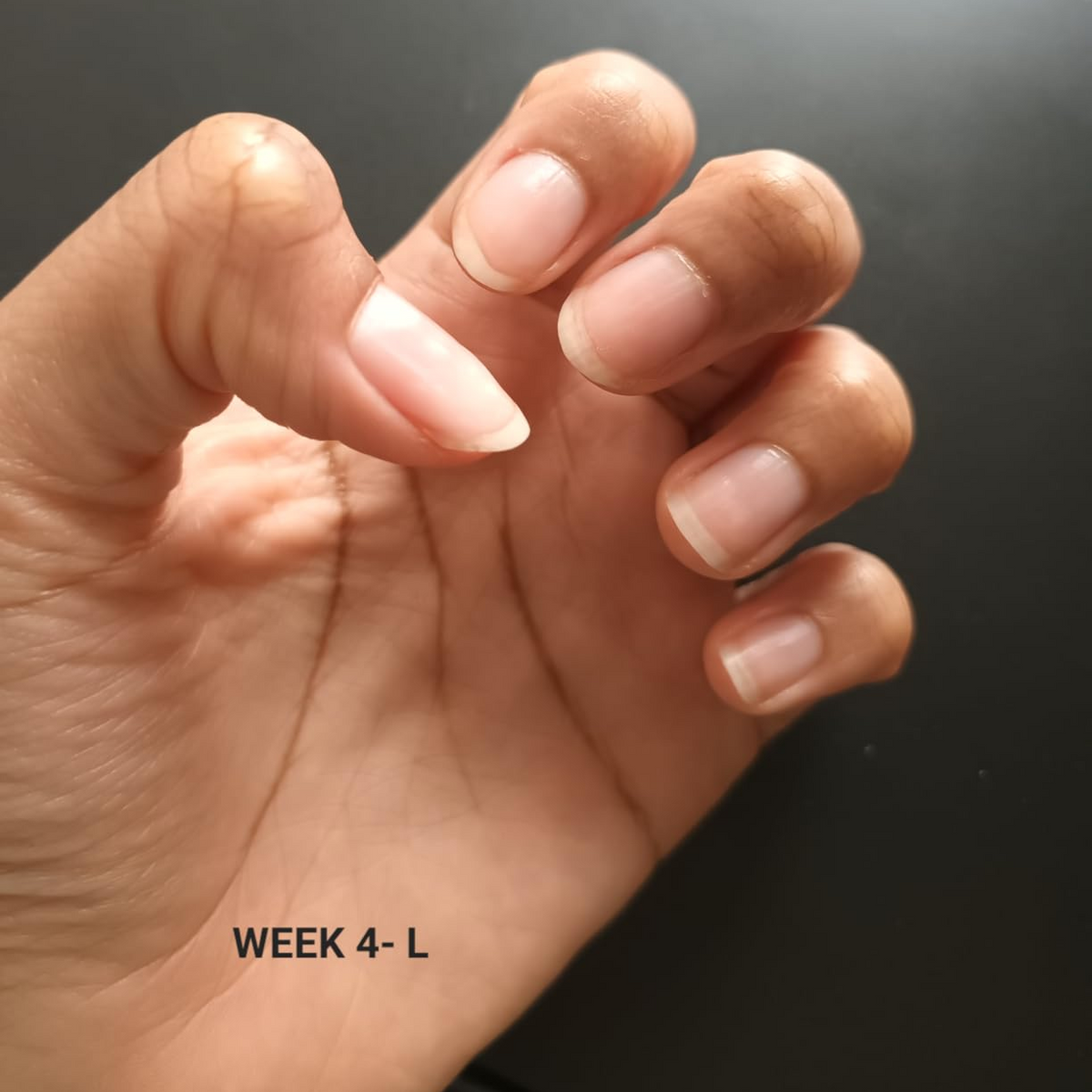 After Nail Growth Serum
