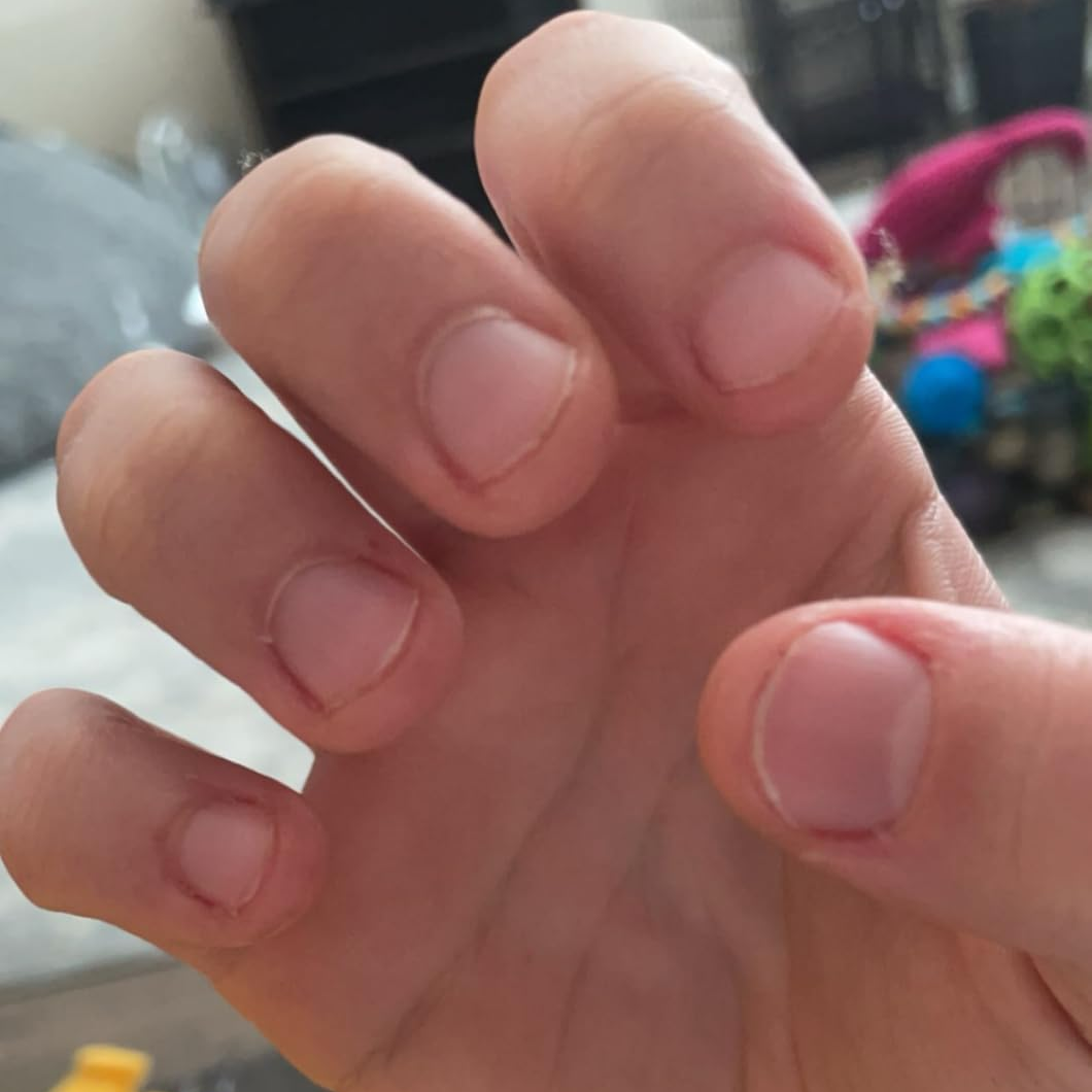 Before Nail Growth Serum