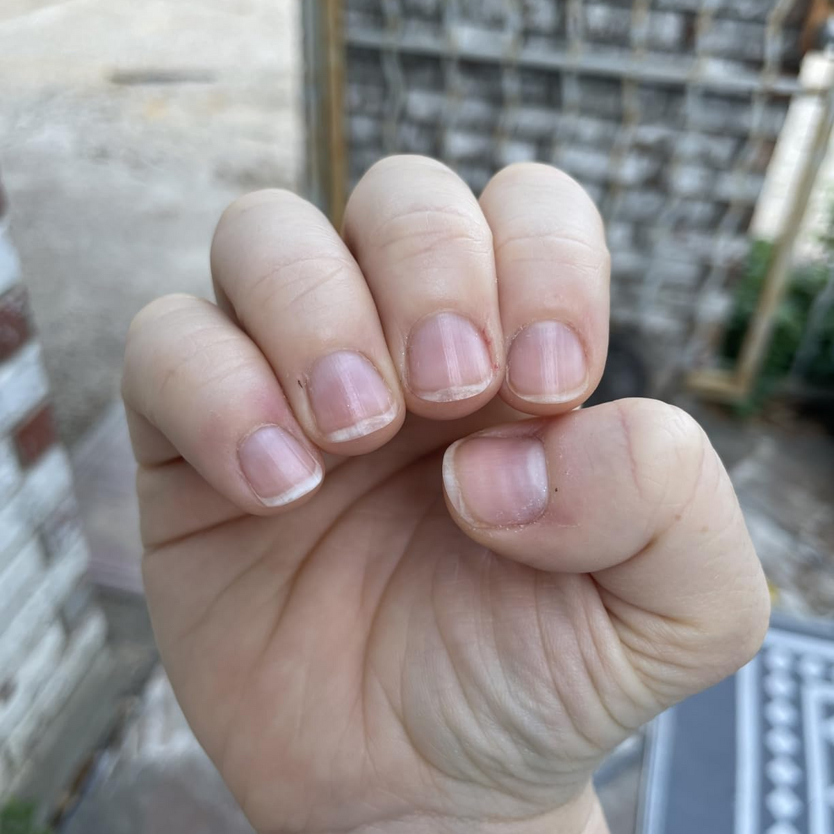 After Duo Day & Night Nails Repair Treatment