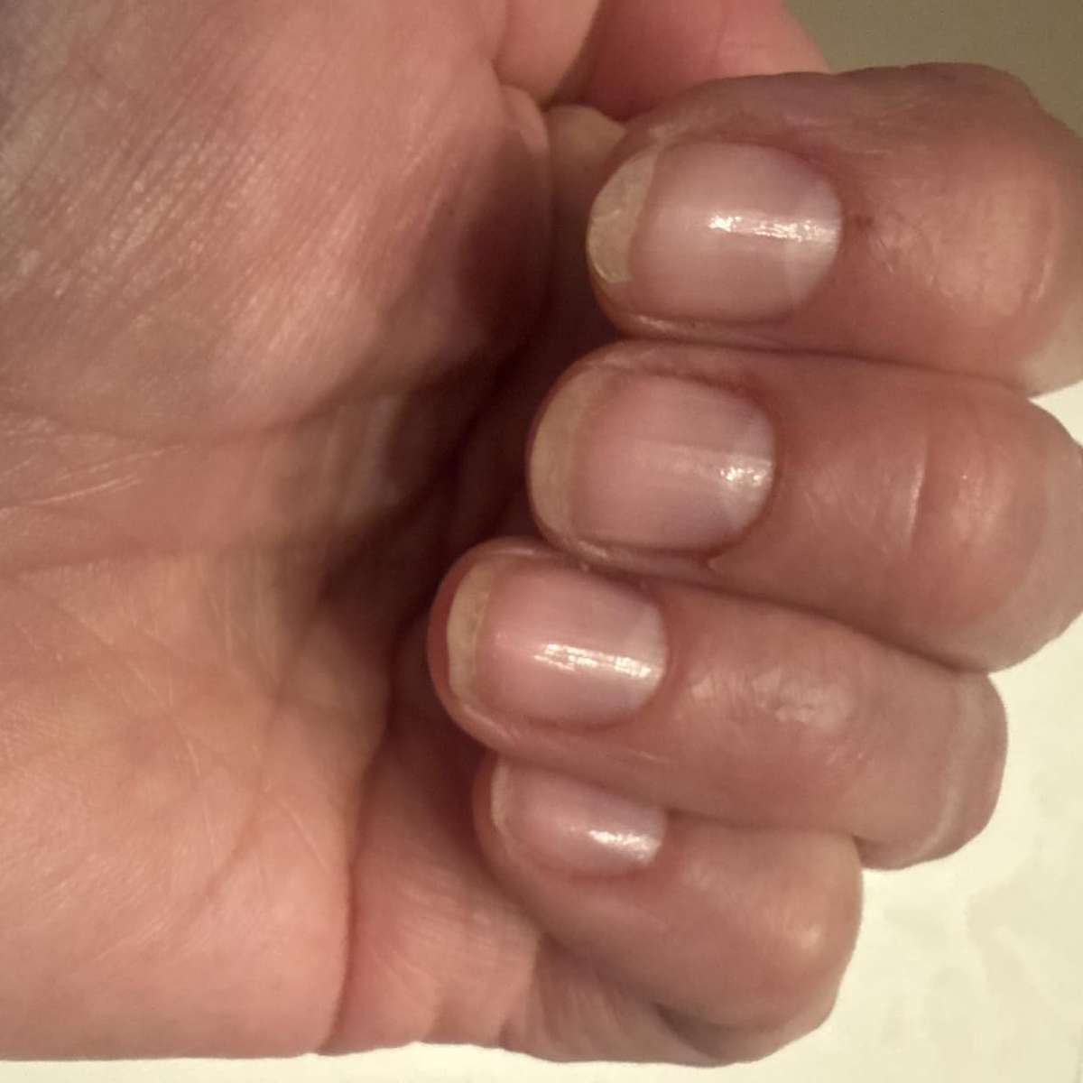 After Duo Day & Night Nails Repair Treatment