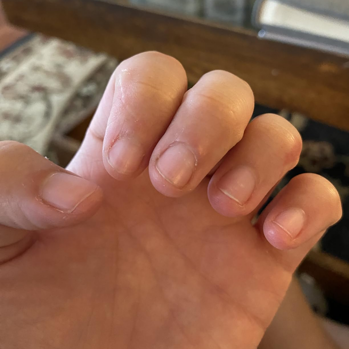 Before Nail Growth Serum