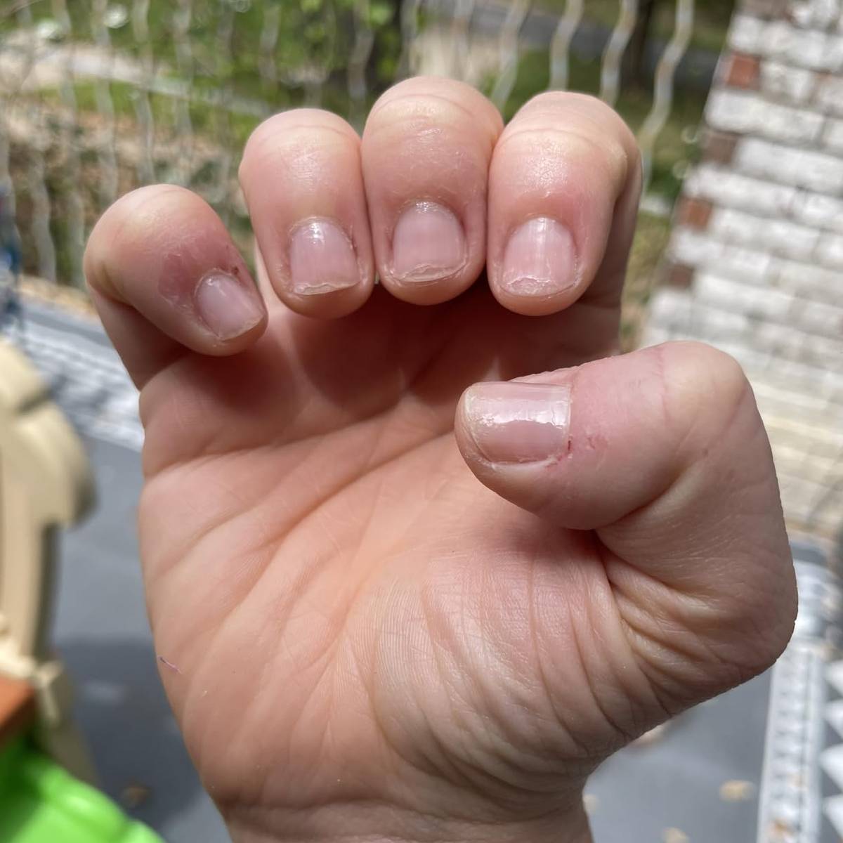 Before Duo Day & Night Nails Repair Treatment