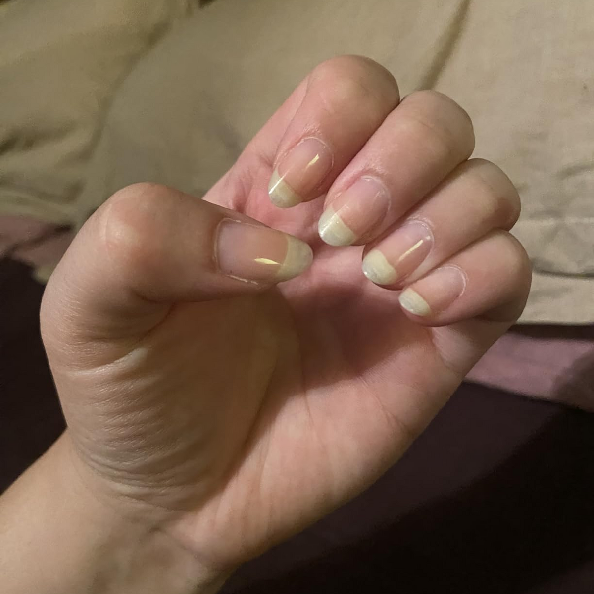 After Nail Growth Serum