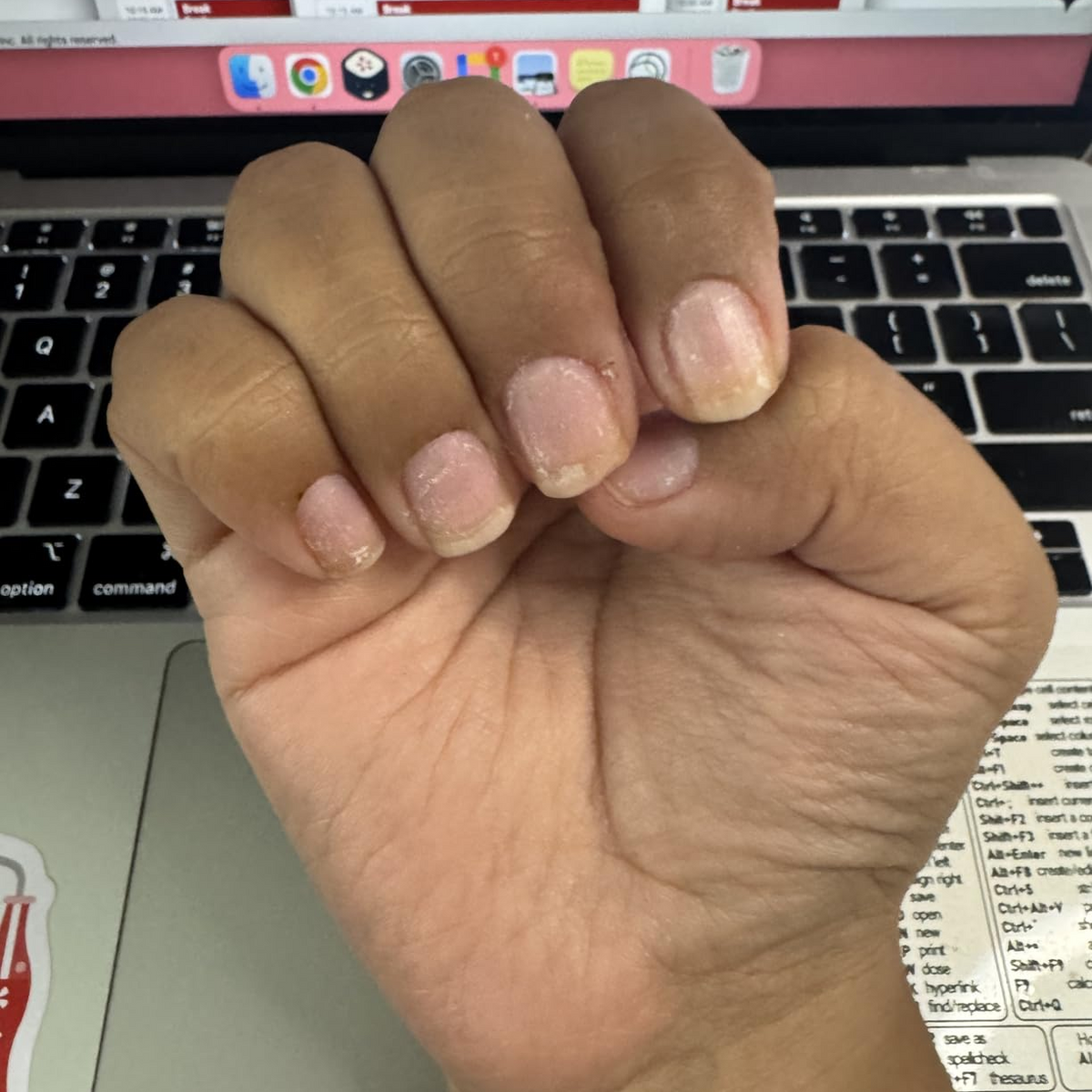 Before Duo Day & Night Nails Repair Treatment