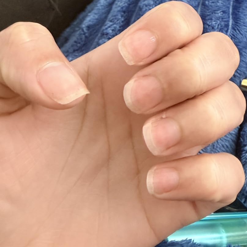 After Nail Growth Serum
