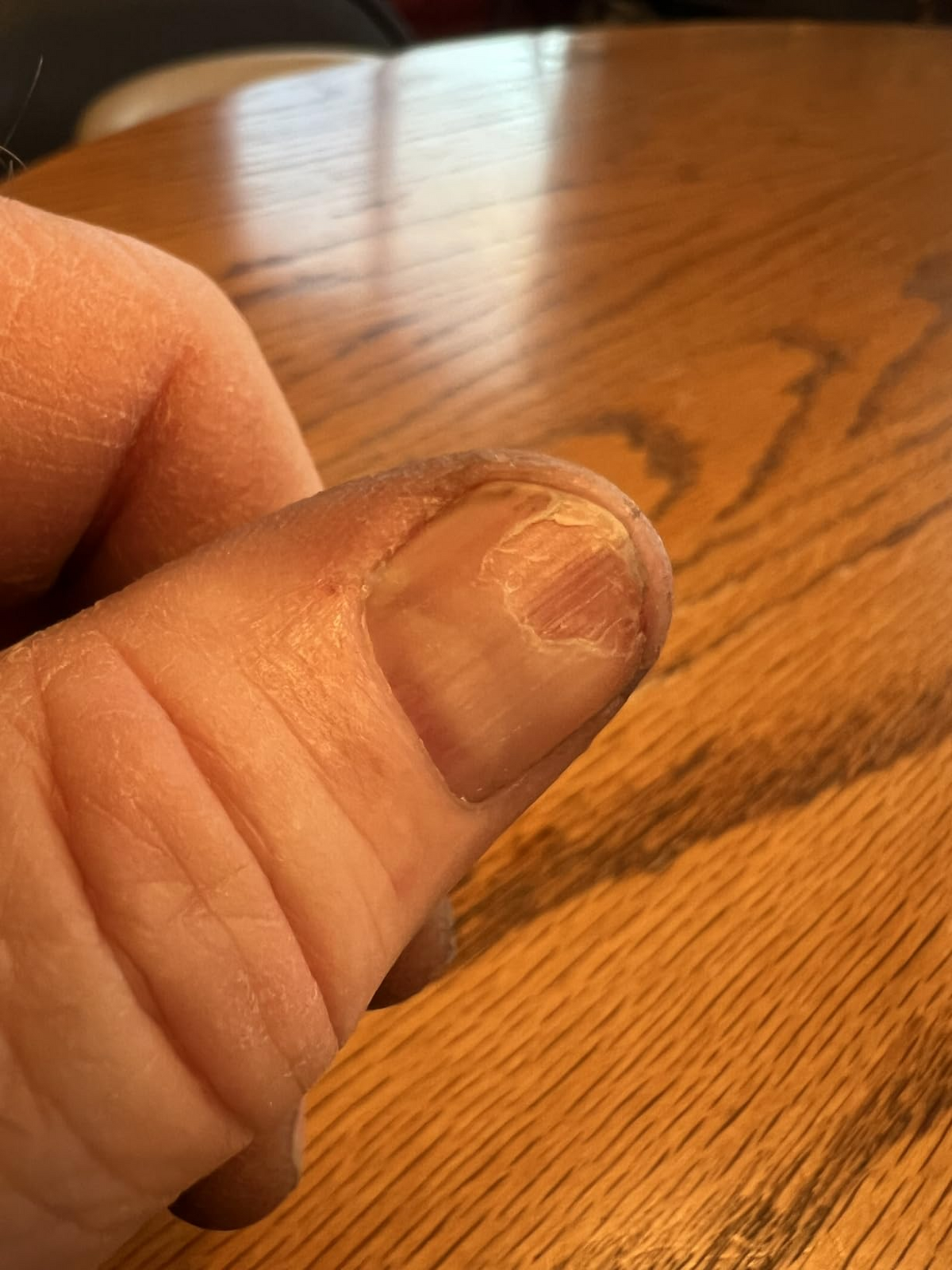 Before Duo Day & Night Nails Repair Treatment