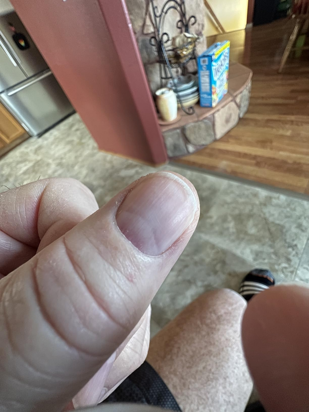 After Duo Day & Night Nails Repair Treatment