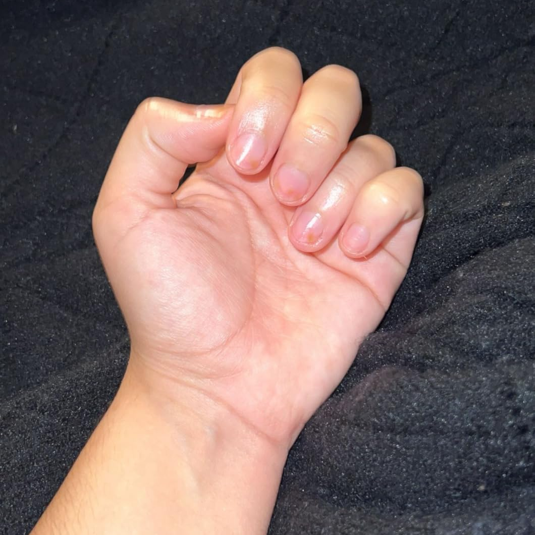 Before Nail Growth Serum