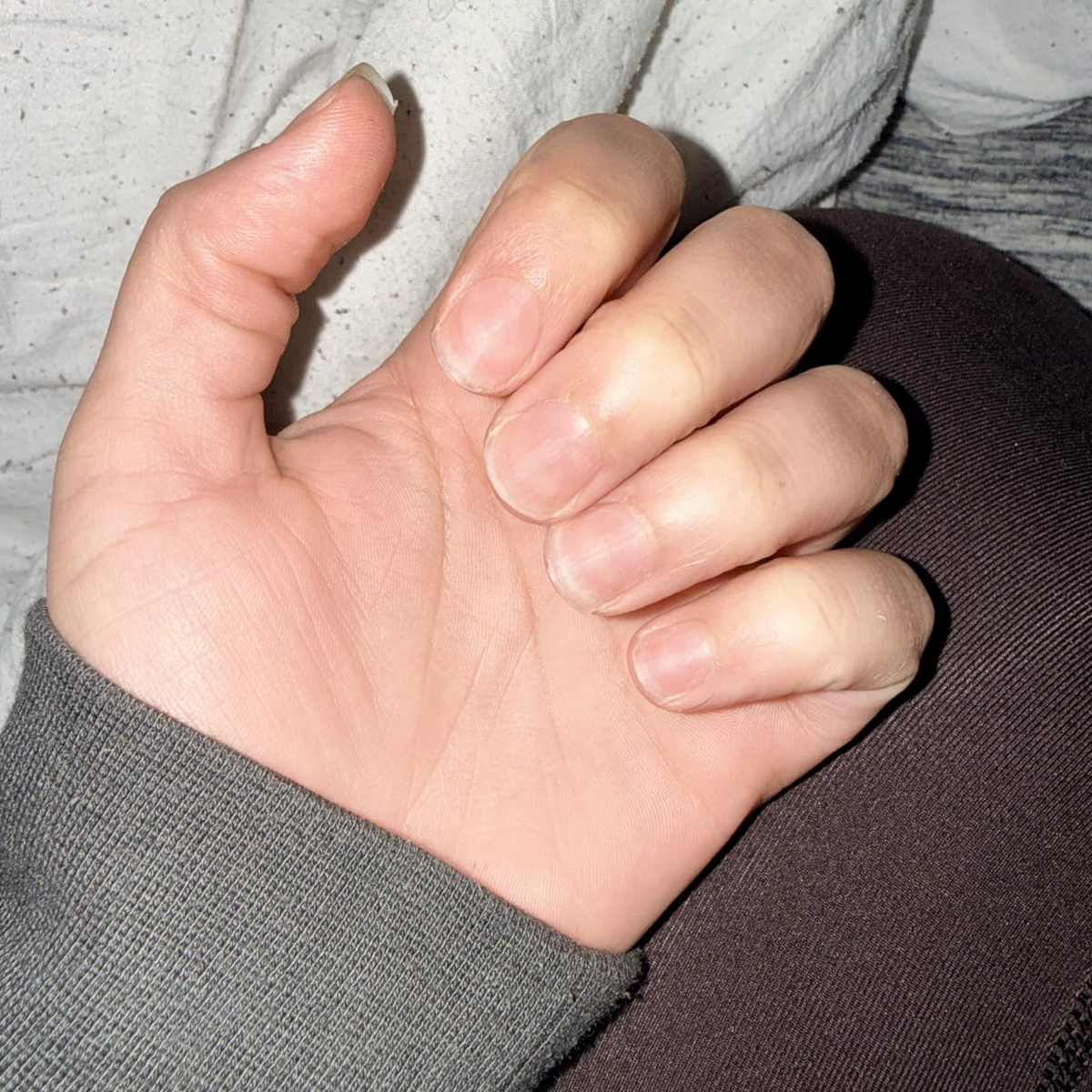 Before Nail Growth Serum