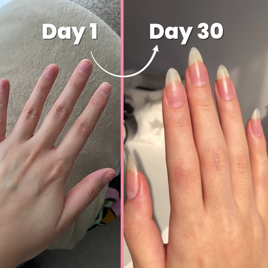 Nail growth serum results - visibly stronger nails week by week
