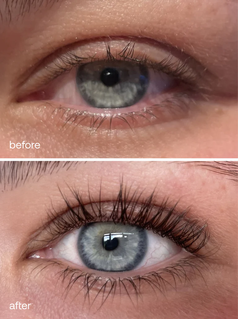 Skale Cosmetics lash growth serum - best eyelash serum for longer lashes