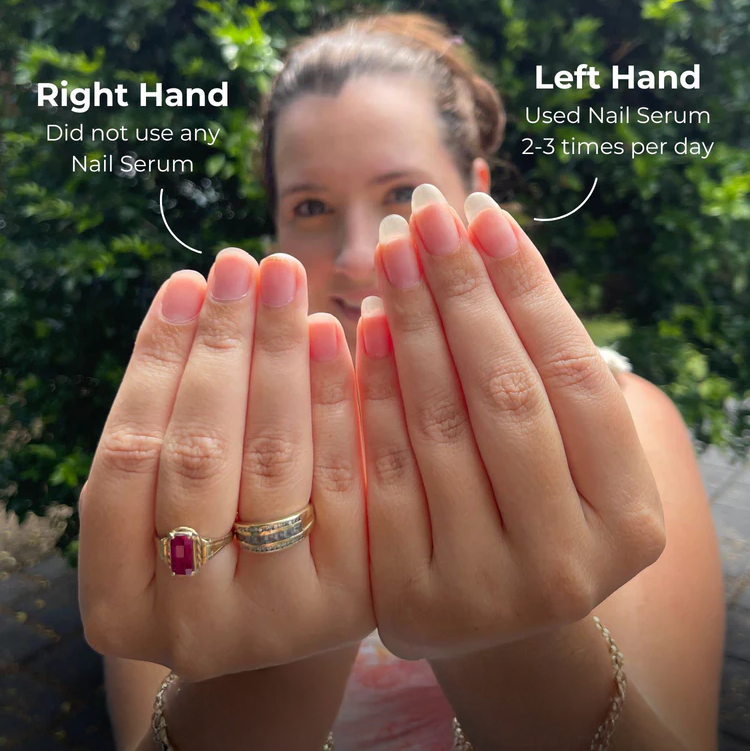 Nail growth serum before and after results - stronger longer nails in 4 weeks